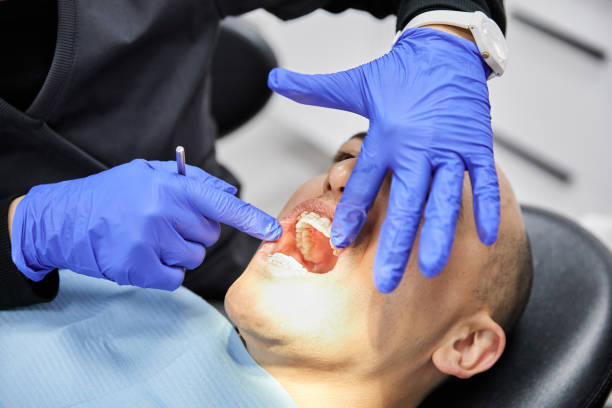 Best Emergency Tooth Extraction in Windcrest, TX